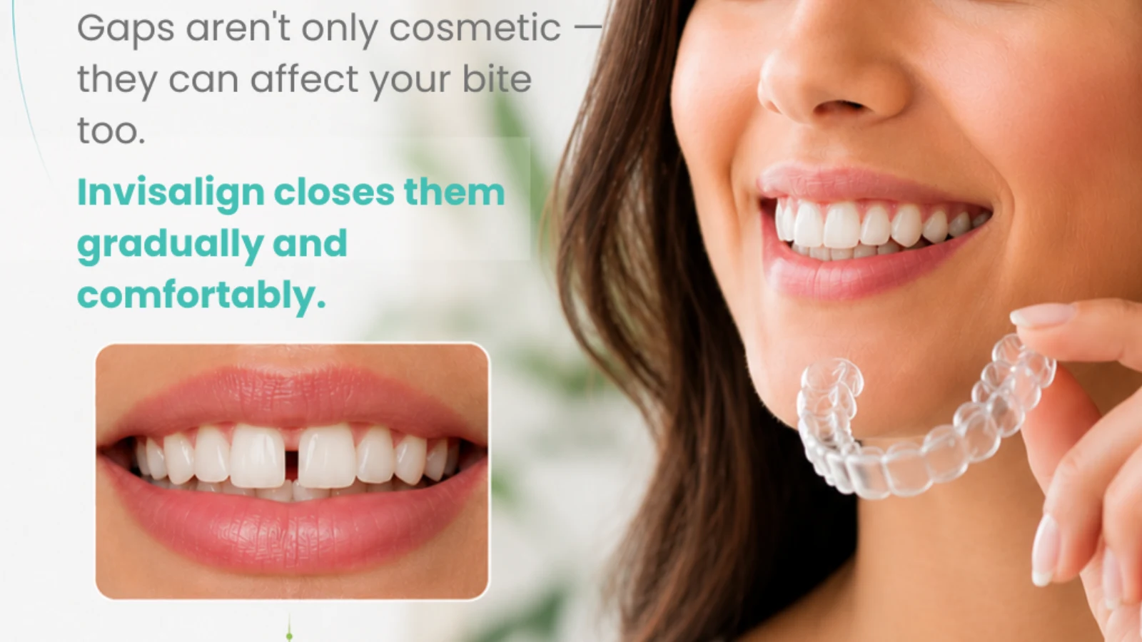 Close-up of woman holding clear Invisalign aligner tray next to a before photo showing gapped front teeth.